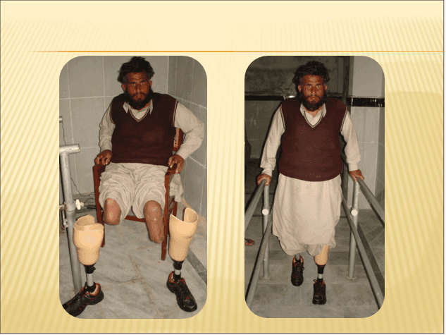 DWS rehabilitation work