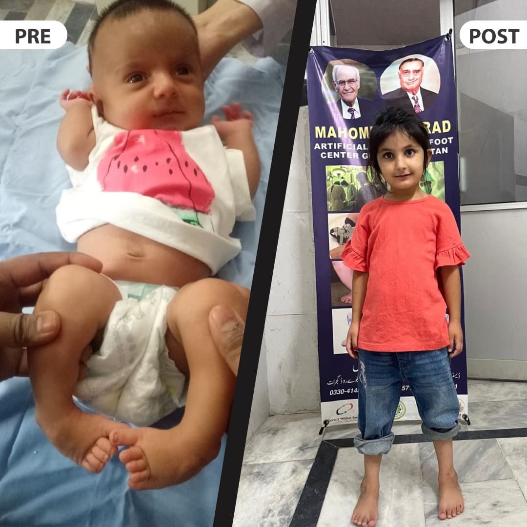 Patient success story